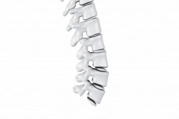Hernia Discal Hernia Discal